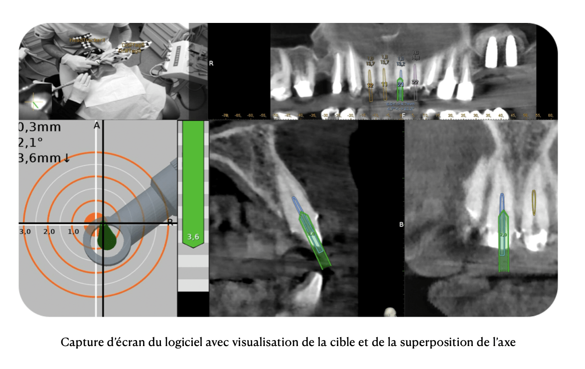 Dr Gregory Fejoz endodontie exclusive Reignier